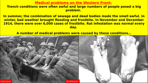 World War One: Injuries and Treatment