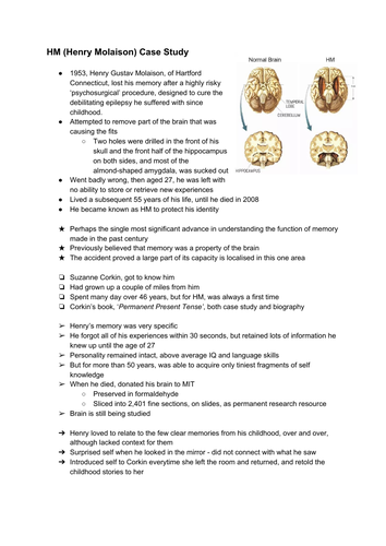 Henry Molaison Case Study Info Sheet - Psychology A Level