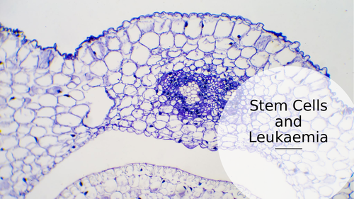 Stem Cells and Leukaemia Introduction