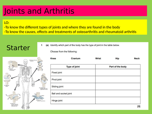 Anatomy and Physiology: Joints and Arthritis, Health and Social Care CTECH level 3