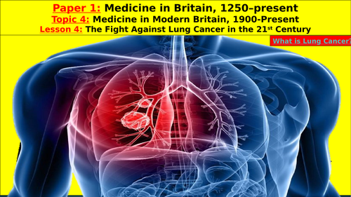 Edexcel GCSE Medicine, Topic 4 - Modern Britain, L4 - The Fight Against Lung Cancer