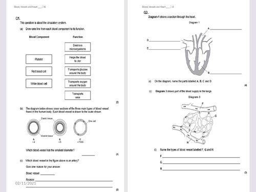 AQA GCSE CHD and Pacemakers