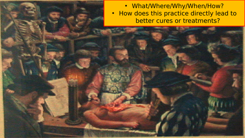 Edexcel Medicine Through Time: Changes in beliefs about causes of disease during the Renaissance