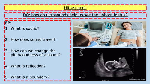 ultrasounds