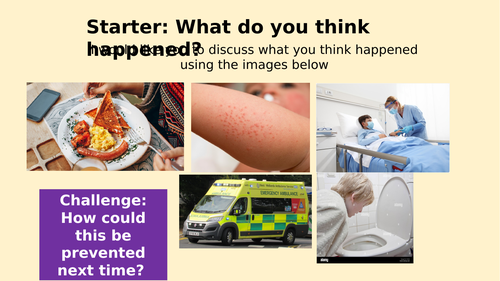 Food Allergies and Food Intolerance