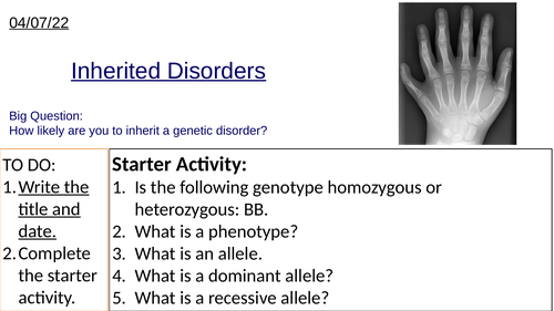 GCSE Inherited Disorders and Punnett Squares