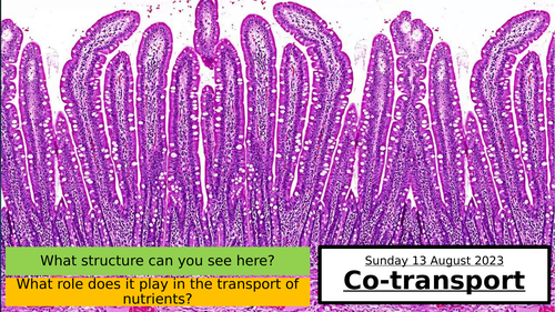 4.5 Co-transport & Absorption of Glucose in the Ileum