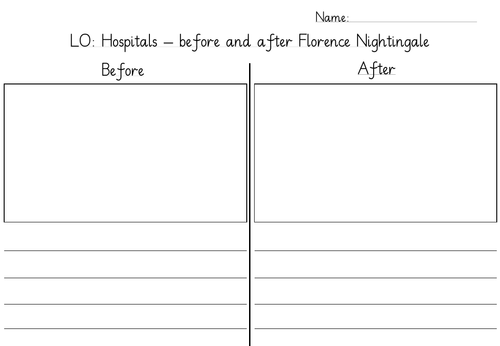Hospitals - Before and After Florence Nightingale