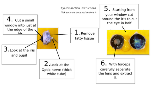 Eye Dissection Practical Instructions (Integrated Instructions Easy to Follow)