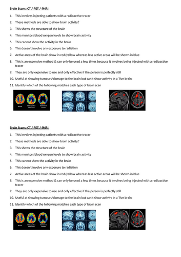 Neuropsychology& Brain Scans GCSE Psychology