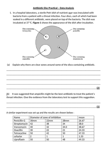 A-Level AQA Biology - Aseptic Technique