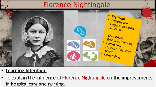 GCSE History – Medicine - Hospital treatment and Nightingale