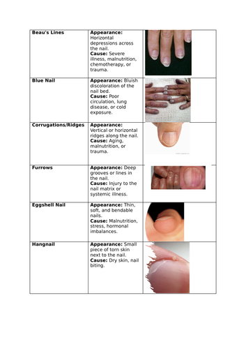 Disorder of nails card sort