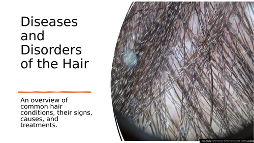 Disorders of the hair