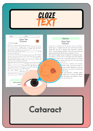 Cloze text - Cataract + Solutions