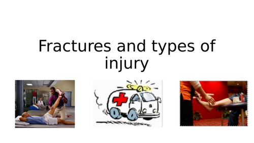 OCR A-Level PE: Topic 9: Injury Full Topic