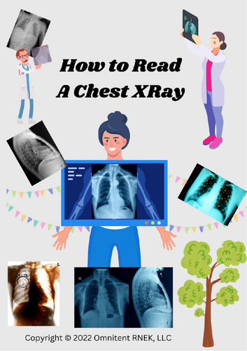 How to Read a Chest X-Ray Just Like a Radiologist Physician! STEM Majors