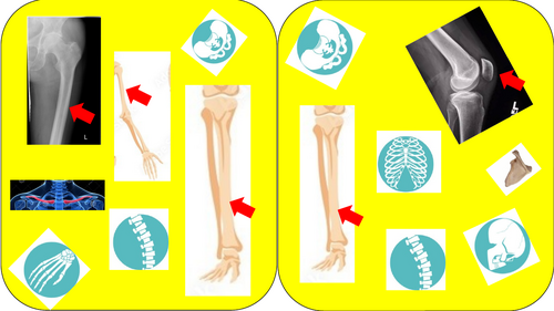 Skeleton revision game