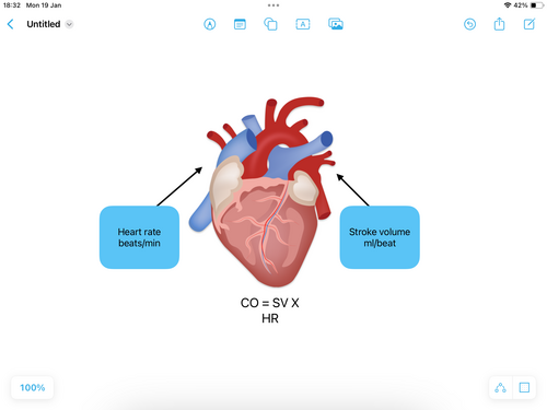 Cardiac output