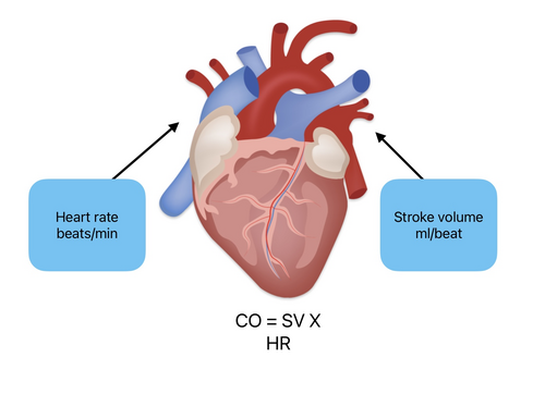 Cardiac output