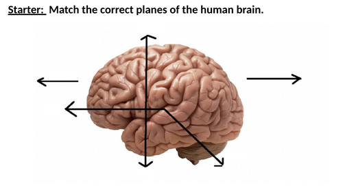 6. Contemporary Study - Schmolck 2002