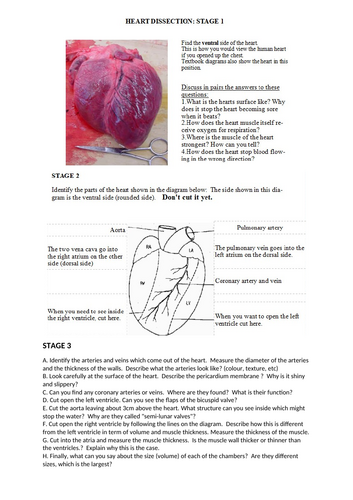 AQA GCSE Biology - B4 - The Heart | Teaching Resources