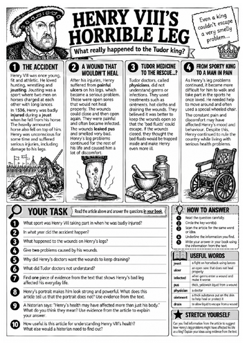 Henry VIII's Horrible Leg | Tudors KS3 Reading Comprehension