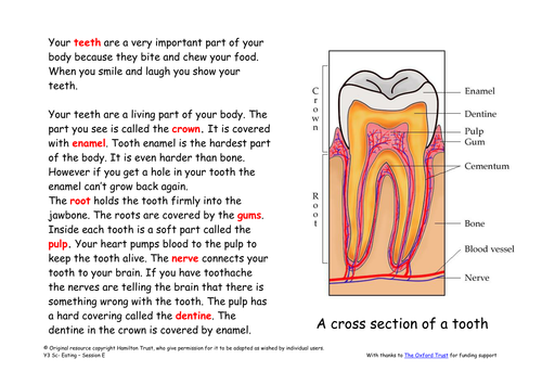 Tooth decay by HamiltonTrust - Teaching Resources - Tes
