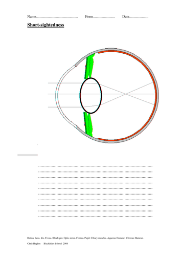 Long and Short Sight