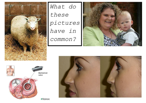 Frankenstein - cloning debate issues