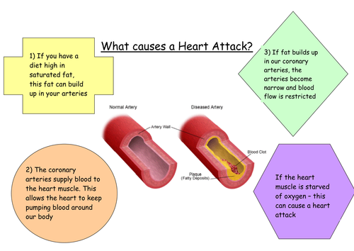 assignment on heart attack