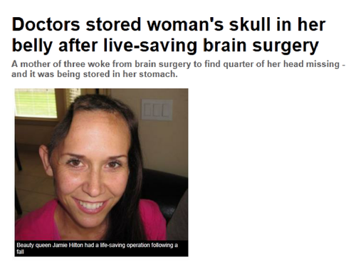 Woman who had her skull in her stomach