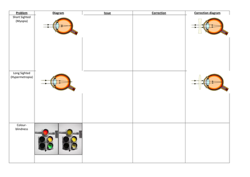 Eye conditions - OCR Gateway B1