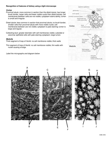 Kidney Identification