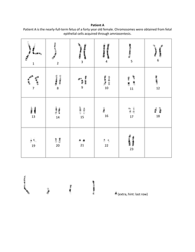 Printables Genetic Disorders Worksheet genetic disorders worksheet abitlikethis powerpoint by sallyuae teaching resources tes