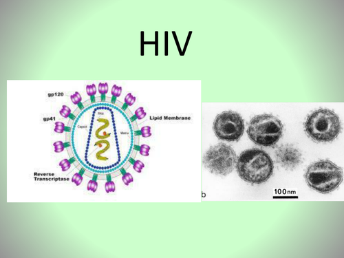 HIV