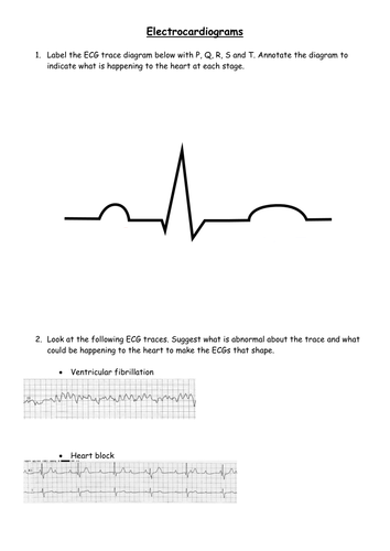 Electrocardiograms worksheet | Teaching Resources