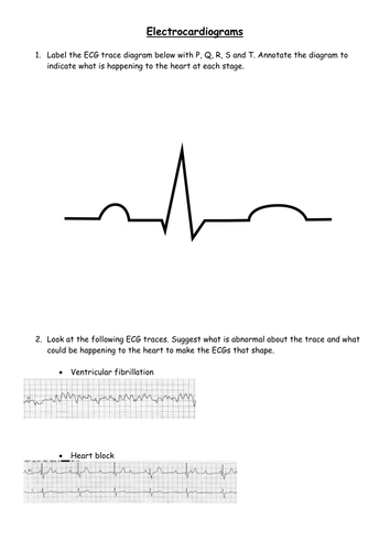 Electrocardiograms worksheet